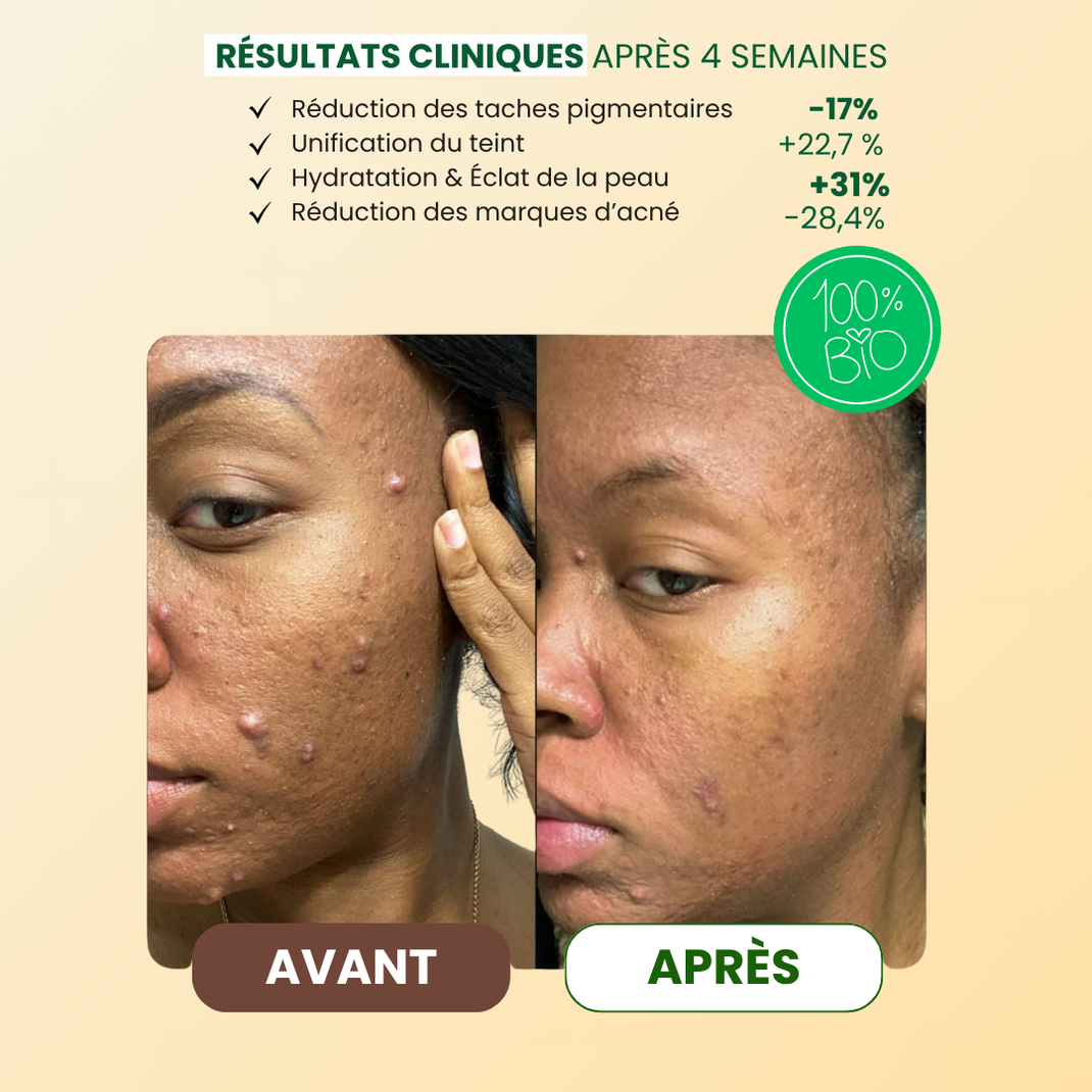 Mousse Purifiante Anti-Taches Au Curcuma